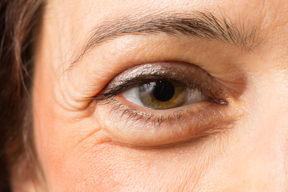 Eyelid Malposition Treatment in Gurugram