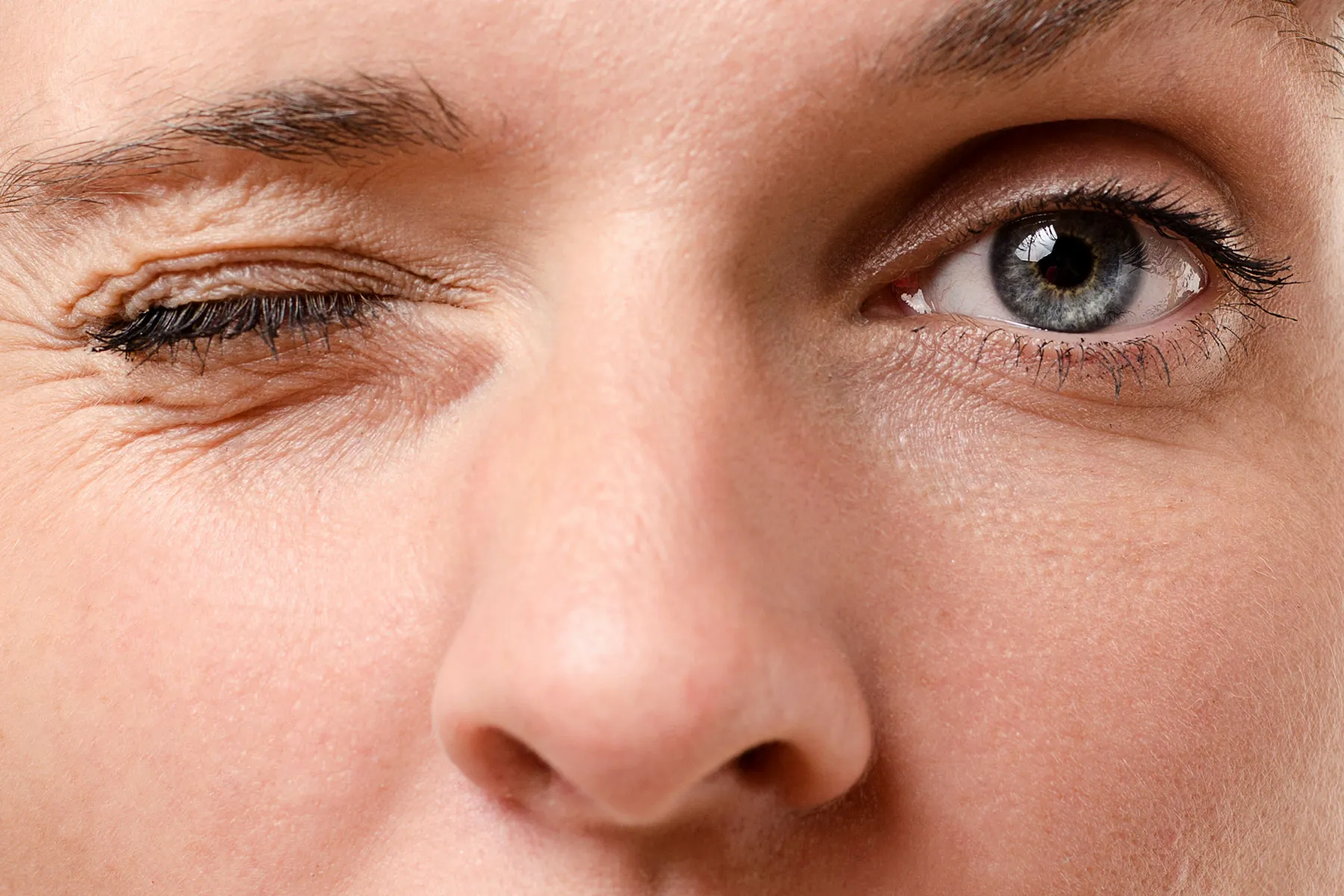 Eyelid Twitching Treatment in Gurugram